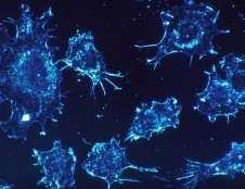 Britai ieško partnerių naujoms technologijoms vėžiui gydyti išbandyti